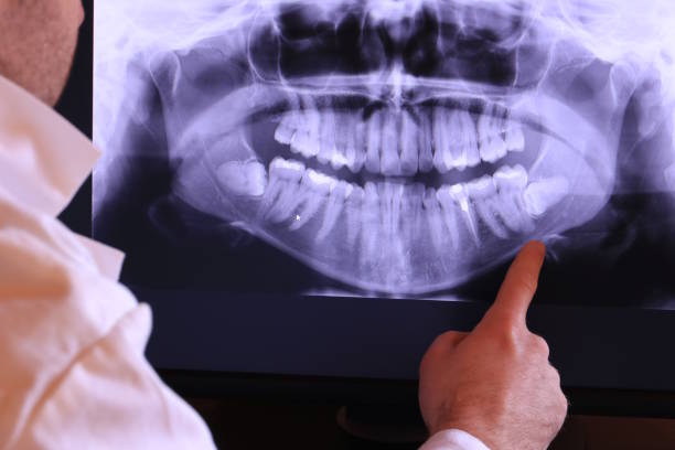 Best Chipped Tooth Repair Near Me  in Boonton, NJ