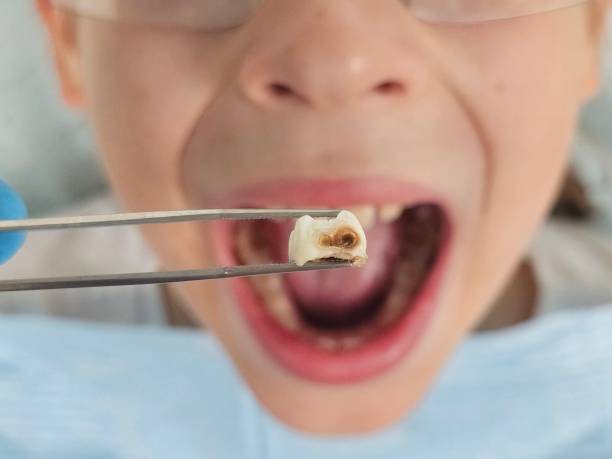 Best Knocked-Out Tooth Emergency  in Boonton, NJ